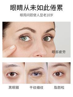 眼周肌肤特殊护理：脂肪粒、干纹、黑眼圈的针对性方案